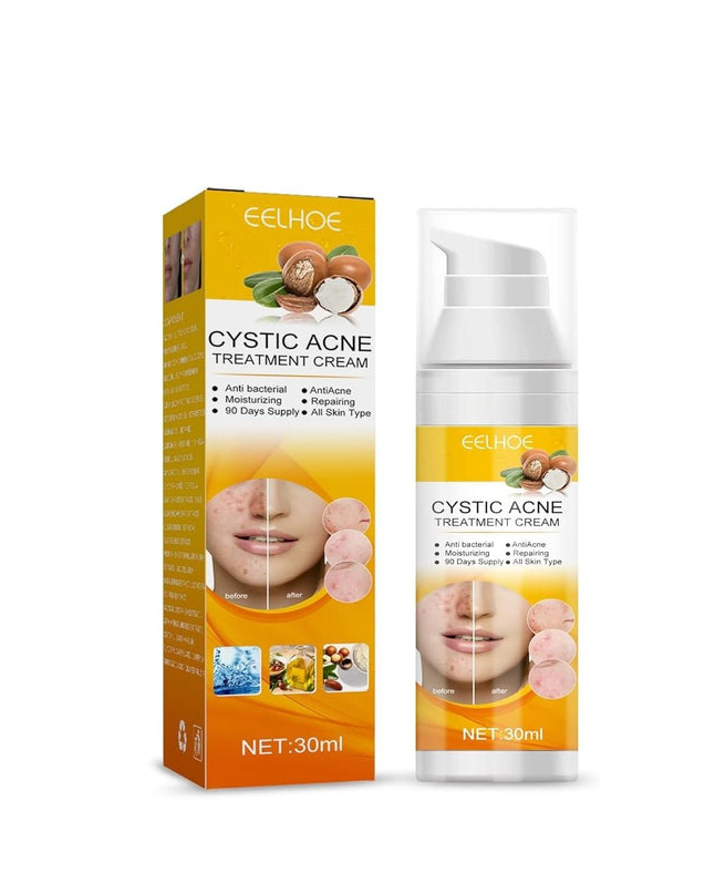 EELHOE Cystic Acne Cream – Targets Deep Breakouts & Clears Skin