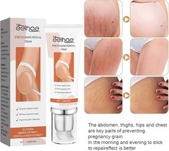 EELHOE Stretch Marks Removal Cream 45g – Fades Marks & Restores Smooth Skin