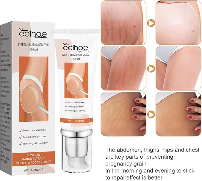 EELHOE Stretch Marks Removal Cream 45g – Fades Marks & Restores Smooth Skin